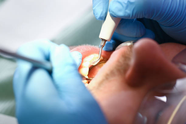 Best Emergency Treatment for Toothache in Palm Valley, FL